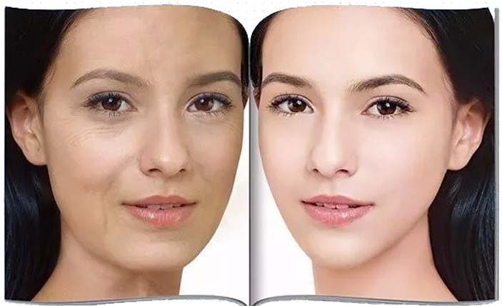 抗衰老效果對(duì)比 女性抗衰老最好的方法是什么?