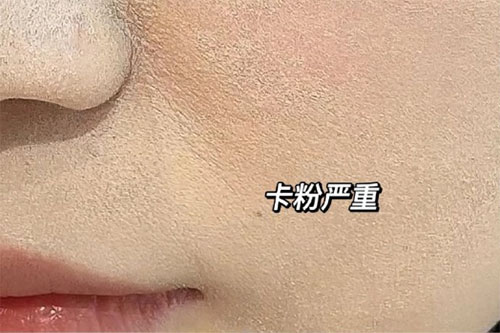 卡粉是什么意思？卡粉是什么原因引起的？