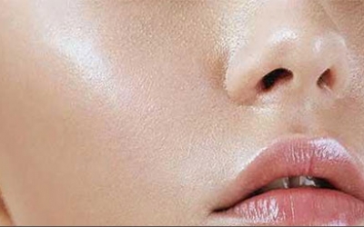 臉上光出油是什么原因？